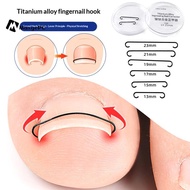[MaxgePC] 2pcs Ingrown Toenail Corrector Tools Pedicure Recover Embed Toe Nail Treatment Ingrown Toe