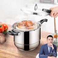 Double Happiness Pressure Cooker 304 Stainless Steel Household Gas Explosion-Proof Induction Cooker Universal Mini Multi-Specification Pressure Cooker