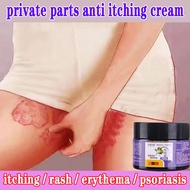 Anti-itch cream Private antibacterial Itching eczema treatment scabies cream ubat gatal kemaluan gatal kemaluan
