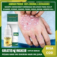 Obat Gatal2 Untuk Kulit - Obat Scabies Untuk Manusia - Salep Penyakit Scabies - Gatal Gatal Scabies 