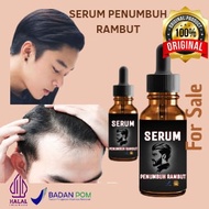 serum penumbuh rambut botak pria/serum penumbuh rambut cepat wanita/serum penumbuh rambut super cepat pria/serum rambut rontok dan penumbuh rambut/serum rambut rontok dan penumbuh rambut ori/serum rambut rontok