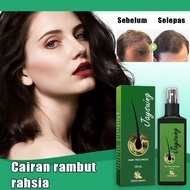 [Rdy Stock] Hair Growth Serum hair growth tonic Hair Growth hair loss hair growth serum, anti-hair l