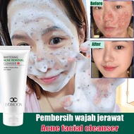 facial mites acne cleanser Acne mites remove Oil control Acne Treatment 黑頭粉刺祛痘膏洗面奶