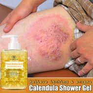 Eczema Shower Gel Eczema Body Wash Calendula Itching Shower Gel 300ml Relieve Eczema Itching Redness