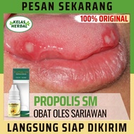 Obat sariawan obat herbal sariawan di lidah obat ngilangin sariawan obat luka di lidah bibir sariawa