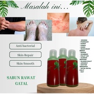sabun gatal/gatal ekzema /panau /gigitan serangga