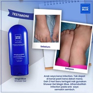 Sabun ekzema / Mandian MAGICBLUE ekzema, kulit kering .. READY STOK