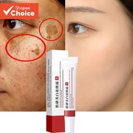 20g Freckle Cream for Face,  Melasma Dark Spots Wrinkles Blemishes (freckle cream), Elasticity & Hyd