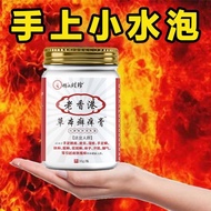 2026新品汗疱疹手上水泡手痒脱皮干裂起水泡皮肤瘙痒湿疹癣真菌感染止痒膏Dyshidrotic eczema: blisters on the hands, itching, peeling, cra