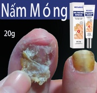 Nail Repair Cream Anti-nail Groove Fungus Removal Anti Onychomycosis Anti Foot Infection Repair Feet