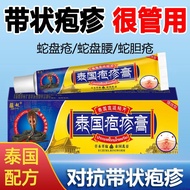 Commented Herpes Post-Genetic Disease Neurosis Snake Discs Flying Snakes Waist-wrapping Dragon Exter