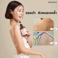 สูตรใหม่! skinness brightening dark spot body lotion ครีมบำรุงผิว