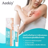 Aeekiy Ekeima Skin Care Cream Gentle Non-Irritating Easy To Carry Use Suitable For All Types Steroid