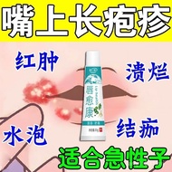Blistering Mouth Herpes Zoster Repair Chapped Lips Dry Cracked Lips Peeling Repeated Cheilitis Speci