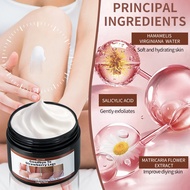 Strawberry Skin Cream: Smooth Bumpy Skin, Improve Strawberry Legs | Body Care Treatment