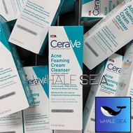 Cerave Acne Foaming Cleanser (150ml)