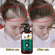 Hair Loss Shampoo Prevents Hair Loss Hair Fall Oil Hair Growth Hair Care Shampoo Rambut Gugur