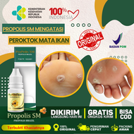 Obat Oles Penghilang Kutil Tahilalat Obat Mata Ikan Di Telapak Kaki Dan Tangan Clavus Kapalan Kulit