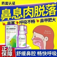 Specializing in Nasal Breathing Meat Nose Meat Balls Continuous Nasal Congestion Facial Swelling Sme