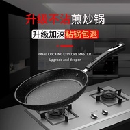 ST/🎀Frying Pan Medical Stone Pan Frying Pan Non-Stick Pan Non-Lampblack Frying Steak Induction Cooker Gas Stove Universa