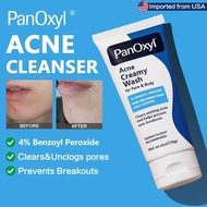Pencil Acne Removal Cleanser 4% Benzoamide (BP) Daily Removal Facial Body Cleanser, Used to Remove, 