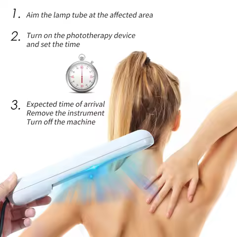Uvb light treatment psoriasis equipment 311nm ultraviolet light treatment medical equipment vitiligo