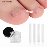 delicatelife 10/20/30/50Pcs Nail Correction Stickers Ingrown Toenail Corrector Patches Paronychia Tr