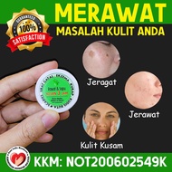 Itchy Medicine, Herbal cream, Treat Acne, Snare, Itchy exzema, Doctor cream Pass KKM