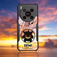 Luxur Phone Casing For ZTE Nubia V70 Max Case Clear Acrylic Fall Prevention Ultra Thin Hard Cover Fo