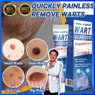 Warts Remover Cream Skin Tag Mole Remover Ointment Warts Cream Warts Removal 20g