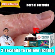 100% Effective Psoriasis Ointment Herbal Anti Itch Cream Psoriasis Cream Eczema Treatment Skin Cream Antibacterial