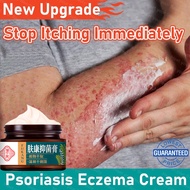 ubat gatal kulit ubat gatal kemaluan antifungal cream eczema cream krim gatal ubat gatal psoriasis K