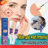 Warts Ointment Pen Black Mole Remover Removing Warts Repairing Skin Lightening Black Moles Warts Mol