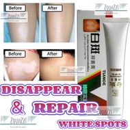 Natural Anti Vitiligo Whitening Skincare Dark Spot Pigmentation Cream Body Ubat Krim Putih Panau Kulit Muka Badan 白汗斑膏