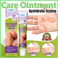 【Sumift】Dyshidrotic Eczema Skin Care Cream Gentle Skin Treatment Ointment 汗疱汗疹护肤膏皮肤护理乳膏