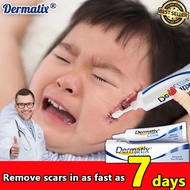 Acne Scar Removal Cream 15g, Burns Scar Foot Mosquito Bite Scar, Skin Acne Scar Repair Fat Striae Tr