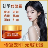 Repair Facial Water After Laser Mole Marks Spot Marks Red Marks Black Marks Universal Fade Acne Mark