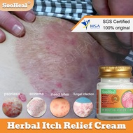 【SooHeal】Anti itch cream For psoriasis ezcema bug bites & skin allergies Fast Relief