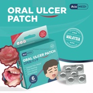 AcuMEDI Oral Ulcer Patch [6's/Box]