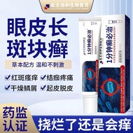 Eyelid plaques, tinea cervix, redness, swollen, itchy, dermatitis, dryness, itchyness, skin care YC眼