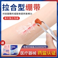 Chain Band-Aid Reducing Sticker Reducing Sticker Children's Facial Scar Wound Stitcher Skin Reducing