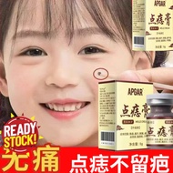 Concentrated Potent Skin Tag Removal APGAR Mole Cream 5g 爆款点痣膏尤痣痦子扁平尤丝状尤尖尤肉刺肉粒脂肪