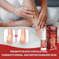 SPRAY ANTI EDEMA semburan anti edema body massage care edema care penjagaan edema