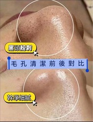🇭🇰 Aqua peel
