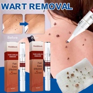 Warts remover original Mole remover Skin tag remover Removal freckle and melanin spots