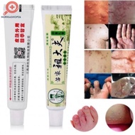 itching cream zudaifu Obat Kulit Gatal Jerawat Ruam Jamur Kudis Kurap krim hijau original gatal sela