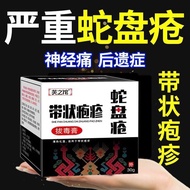 With Herpes Post-Genetic Diseases Neuropathy Snake Disc Herpes Flying Snake Waist-wrapping Dragon Ex