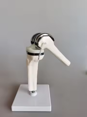 1:1 Human Knee Joint Replacement Model, Artificial Knee Prosthesis Anatomy Model for Medical Educati