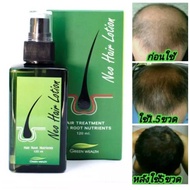 NEO HAIR LOTION ORIGNAL SPRAY 100% Hair Transplant and Hair Loss Treatment GMP Green Wealth hair gro