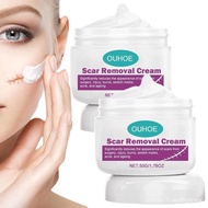 ScarRemoval,AdvancedScarGelforFaceBodyLeg,Soft,ooth,GentleforAllTypes(2pcs) SIJI I0PX